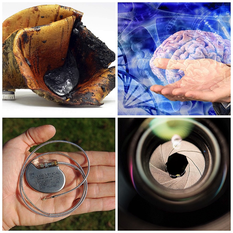 Microwaves and Micro RNA Patch Pacemakers